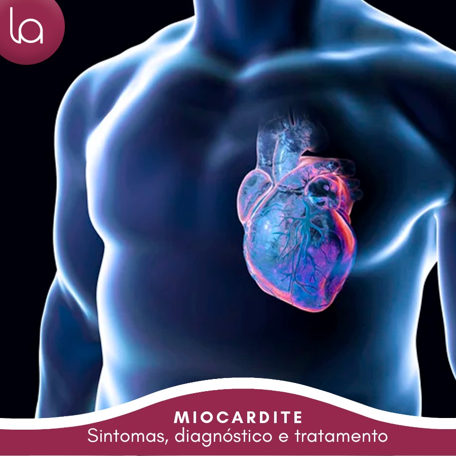 miocardite-sintomas-causas-tratamento-curitiba-loyola-e-avellar-clinica-medica