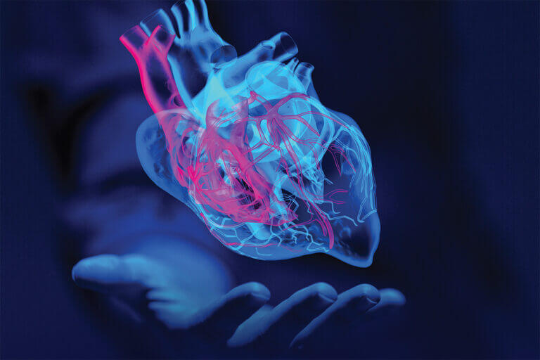 cardiomiopatia hipertrófica