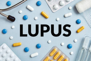 Deucravacitinib e Orelabrutinib: possíveis novos medicamentos para lúpus: novo tratamento?