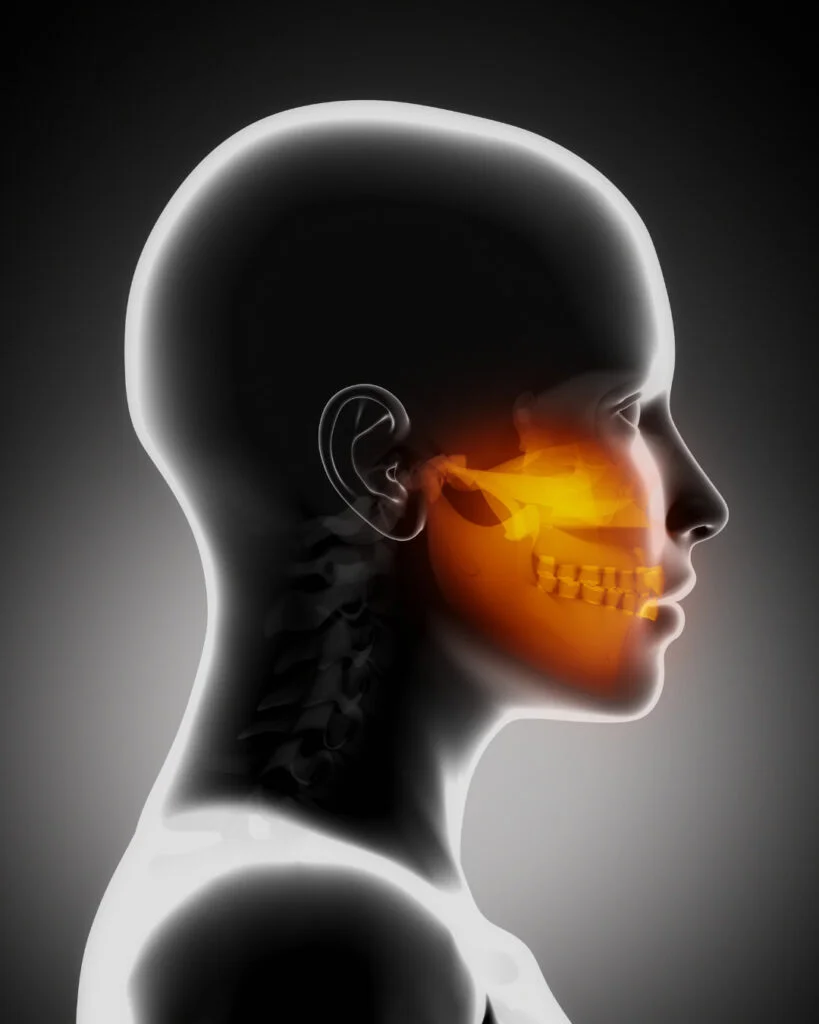 Quais são os principais sintomas da ATM/DTM? - Ortodontia Curitiba