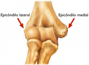 Epicondilite - Osso úmero onde se encontram os epicôndilos