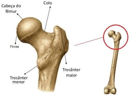 região trocantérica - bursite no quadril